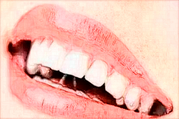 2024成都新橋口腔醫(yī)院拔牙收費(fèi)標(biāo)準(zhǔn)?拔牙痛不痛?