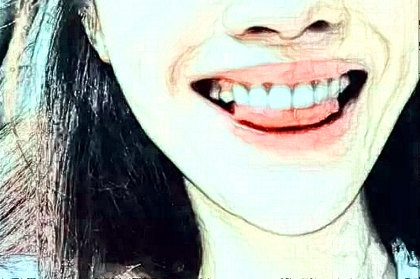 2024重慶世紀(jì)美奧口腔醫(yī)院做冷光美白費(fèi)用?冷光美白牙齒疼嗎