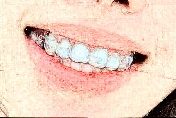 重慶維樂口腔醫(yī)院洗牙哪個(gè)醫(yī)生好?2024洗牙多少錢