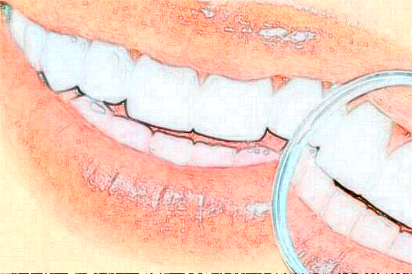 重慶團(tuán)圓口腔醫(yī)院拔智齒怎么樣?拔智齒要花多少錢?