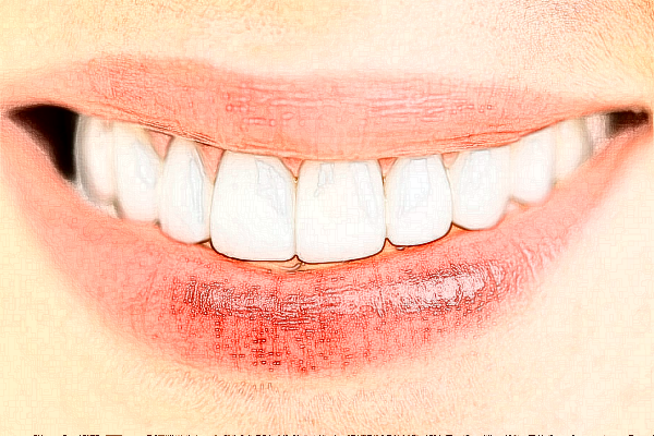 2024中山香山口腔醫(yī)院補(bǔ)牙價(jià)格?補(bǔ)牙哪個(gè)醫(yī)生好?