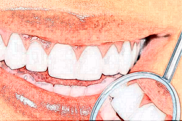 2024貴陽柏德口腔醫(yī)院牙齒矯正好么?醫(yī)生推薦+整形案例參考~