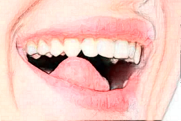 淮安諾貝爾口腔醫(yī)院全口種植怎么樣，附醫(yī)生信息一覽~