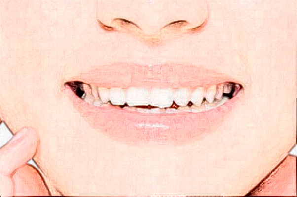 贛州貝殼口腔矯正牙齒怎么收費?哪個醫(yī)生做得好