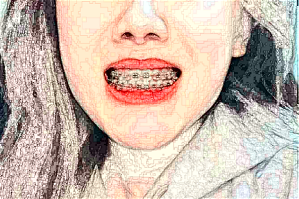 成都茁悅口腔根管做的好嗎?哪位醫(yī)生做得好