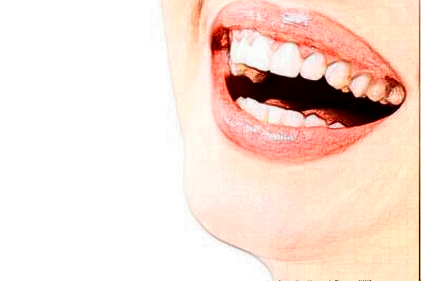 2024太原眾牙口腔醫(yī)院怎么樣？值得去嗎