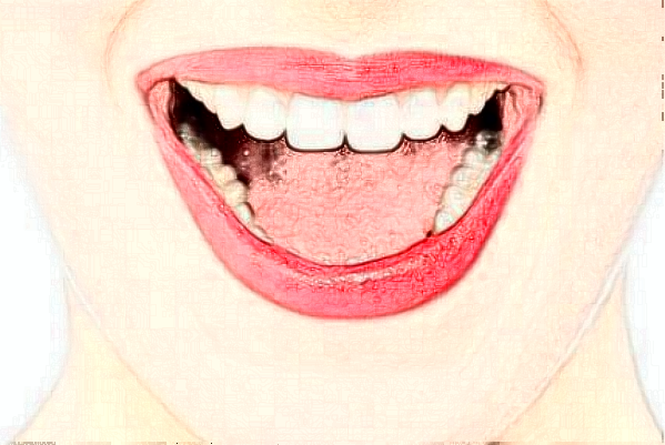 天津南開醫(yī)院前牙種植費用多少_醫(yī)生名單