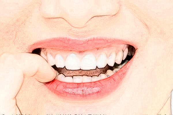 長沙科爾雅口腔醫(yī)院單牙種植價格多少?整形日記全過程分享