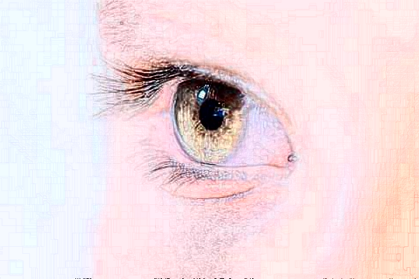 無錫市人民醫(yī)院全飛秒好嗎?附價格表+案例