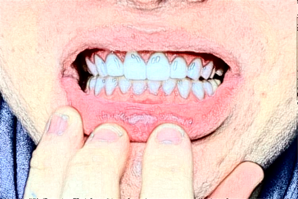 2024太原眾牙口腔醫(yī)院補(bǔ)牙多少錢?做的怎么樣