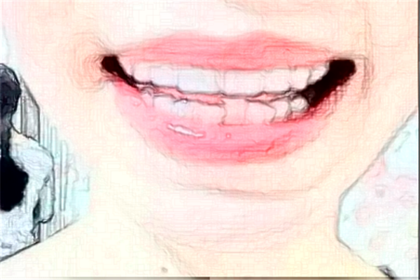 貴陽柏德口腔醫(yī)院隱適美怎么樣_專家信息_案例大全欣賞