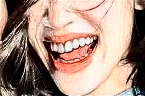 長沙科爾雅口腔醫(yī)院半口種植案例_專家介紹