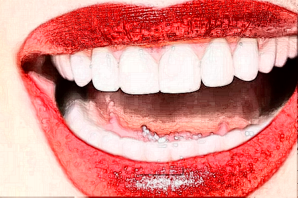 山東鉑爾口腔好不好_醫(yī)生靠譜嗎_案例