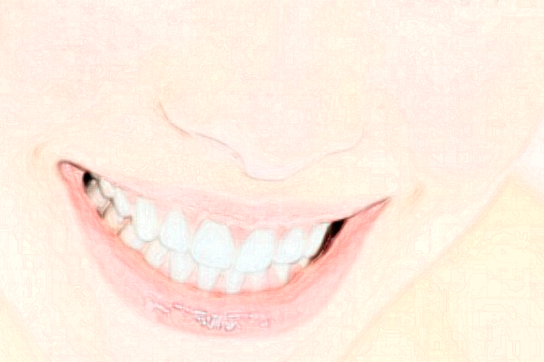 2024成都茁悅口腔拔牙好嗎_真實(shí)案例發(fā)布