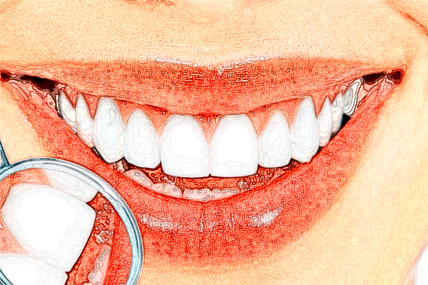 2024福州美橙口腔牙齒貼面好不好?附術(shù)后案例參考!