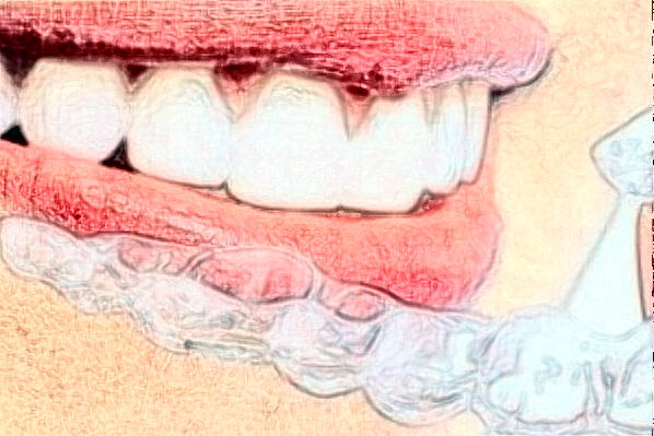 山東鉑爾口腔種植牙做的好嗎?案例欣賞+醫(yī)生名單!