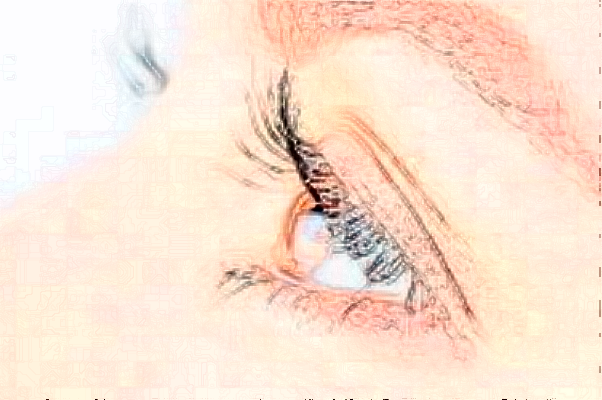 2024遼寧省人民醫(yī)院全飛秒費用多少?整形日記全過程