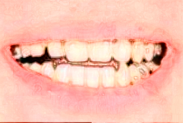 深圳樂莎莎口腔醫(yī)院比較好的醫(yī)生?2024醫(yī)生收費(fèi)價格