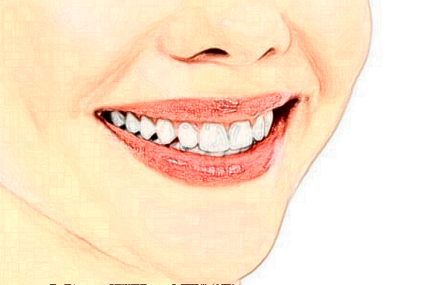 2024重慶團(tuán)圓口腔醫(yī)院齙牙矯正價(jià)格多少?齙牙矯正好嗎