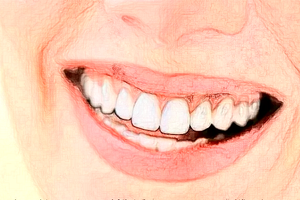 武漢德韓口腔醫(yī)療隱適美好嗎?隱適美和時(shí)代天使區(qū)別