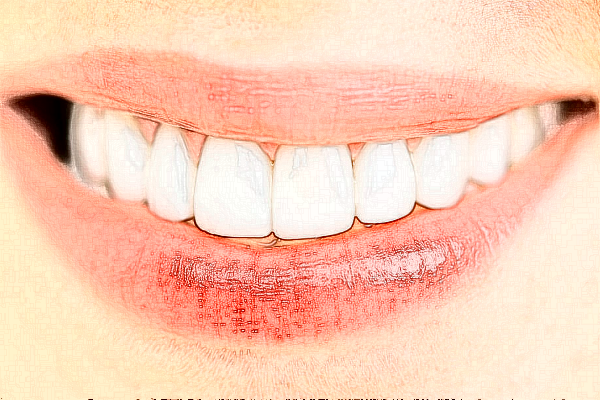 宣城大醫(yī)醫(yī)院種植牙的特點(diǎn)?種植牙的種植體系