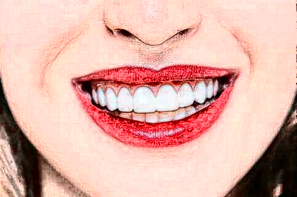 2024淮安諾貝爾口腔醫(yī)院瓷貼面哪個醫(yī)生好?專家名單+案例反饋