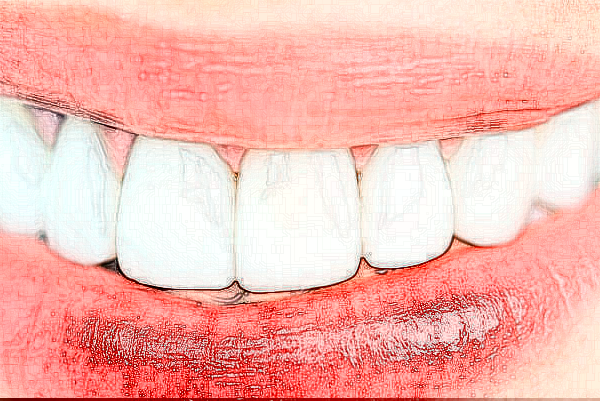 長沙科爾雅口腔醫(yī)院補牙做的好嗎?哪位醫(yī)生做得好