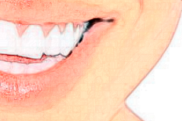 鄭州唯美口腔醫(yī)院根管怎么樣_價格表_案例_地址