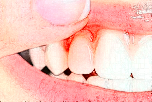 鄭州唯美口腔醫(yī)院根管怎么樣_價格表_案例_地址