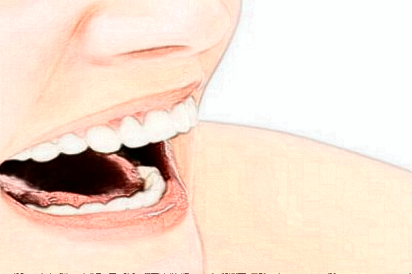 成都圣貝牙科醫(yī)院拔牙好的醫(yī)生推薦_美容日記展示