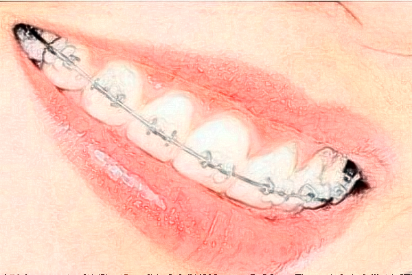 2024成都茁悅口腔超聲波洗牙好的醫(yī)生推薦_美容日記展示