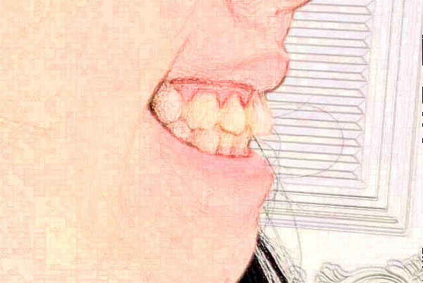 深圳樂莎莎口腔醫(yī)院醫(yī)生怎么樣?2024牙齒矯正怎么收費