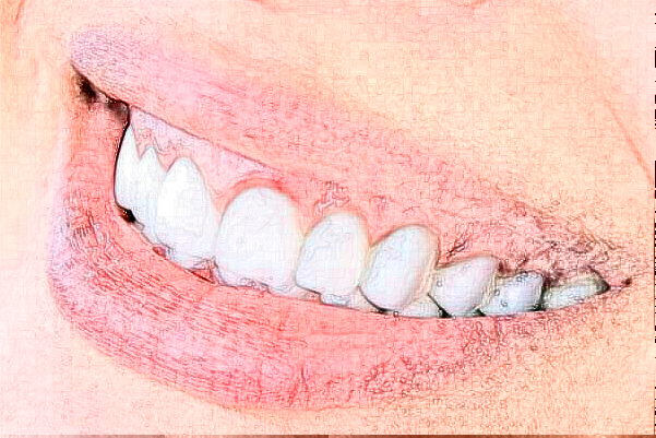 武漢德韓口腔醫(yī)療牙齒矯正的危害?牙齒矯正年齡范圍