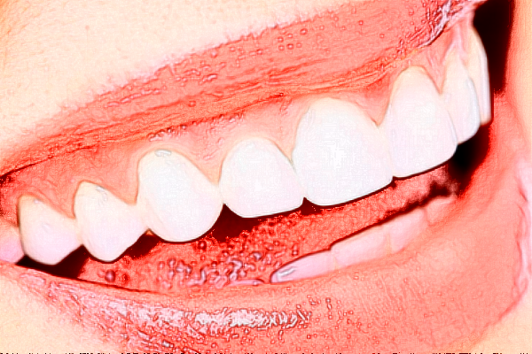 2024深圳樂莎莎口腔醫(yī)院隱形矯正價(jià)格?隱形矯正的優(yōu)點(diǎn)