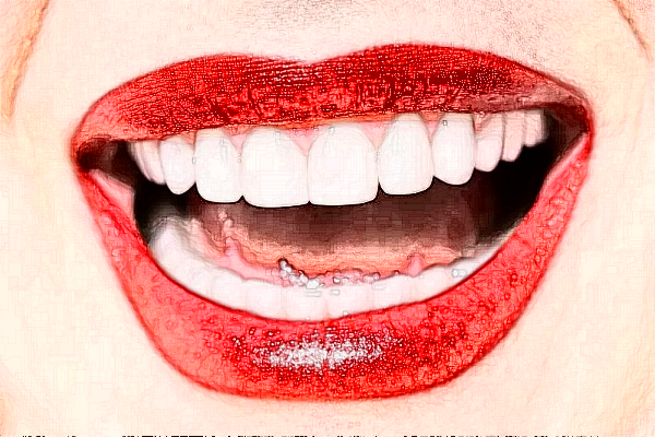 2024宣城大醫(yī)醫(yī)院金屬托槽矯正價(jià)格?金屬托槽矯正好嗎