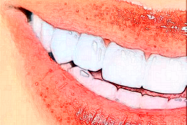 2024貴陽(yáng)柏德口腔醫(yī)院前牙種植費(fèi)用多少?整形日記全過程