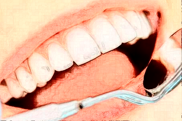 2024襄陽新德恩口腔門診部牙齒矯正費用多少_真實案例反饋