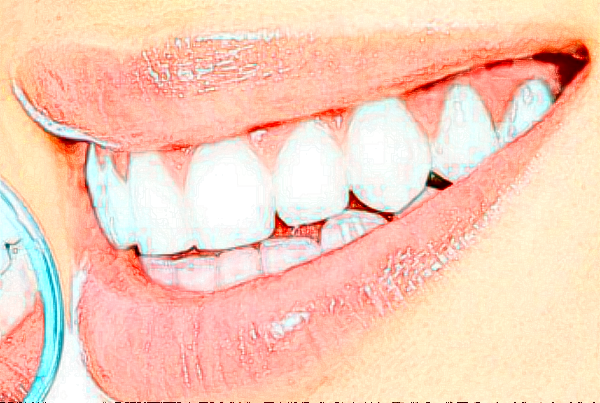 2024襄陽新德恩口腔門診部牙齒矯正費用多少_真實案例反饋