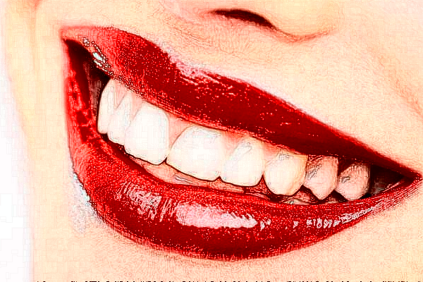 2024福州美橙口腔美學修復好不好?附術后案例參考!