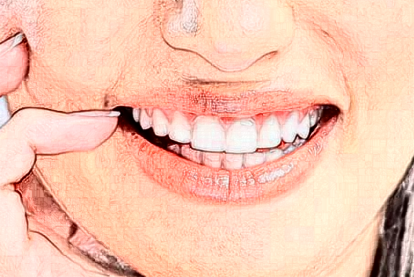 2024福州美橙口腔美學修復好不好?附術后案例參考!