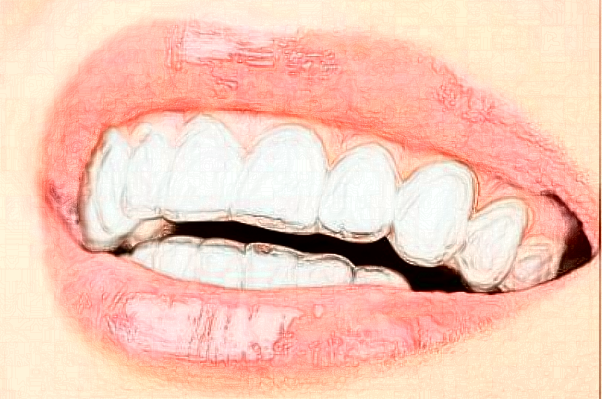 長(zhǎng)沙科爾雅口腔醫(yī)院冷光美白做的好嗎?哪位醫(yī)生做得好