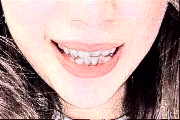 福州福能海峽口腔醫(yī)院正畸價(jià)目表(價(jià)格表)怎么樣