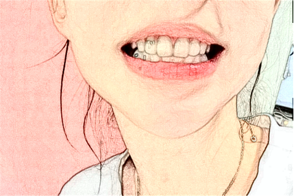 2024長沙好大夫口腔醫(yī)院拔牙怎么樣_體驗(yàn)日記分享