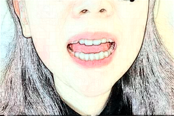 遼寧省人民醫(yī)院全口種植價目表(價格表)_口碑怎么樣