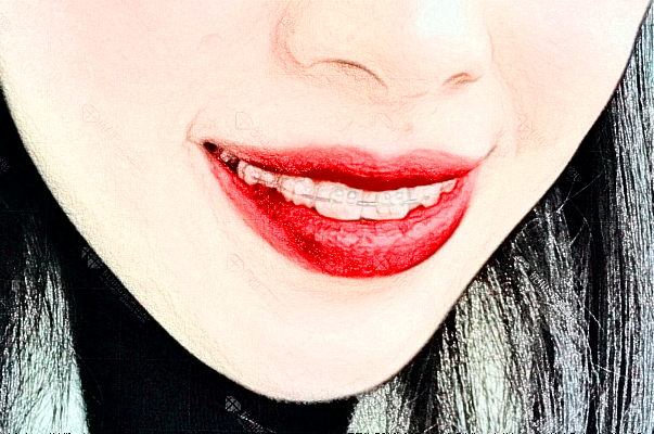 武漢德韓口腔醫(yī)療補(bǔ)牙的步驟有哪些?2024補(bǔ)牙價(jià)格公布