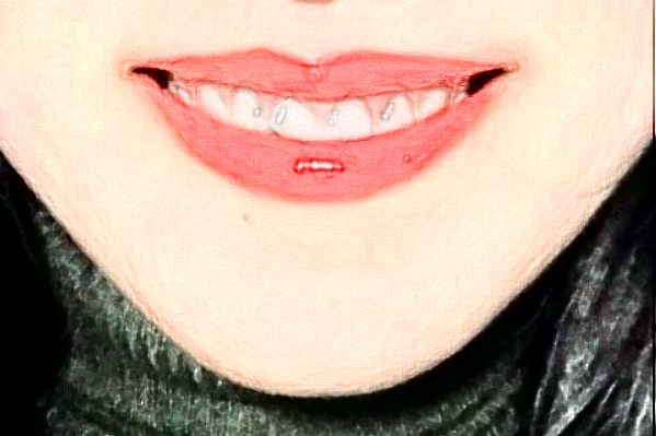 武漢德韓口腔醫(yī)療醫(yī)生怎么樣?2024矯正牙齒的費(fèi)用