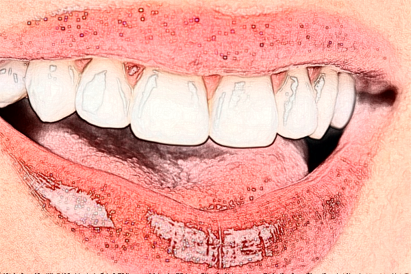 2024義烏傅氏口腔門(mén)診部根管費(fèi)用?根管好嗎