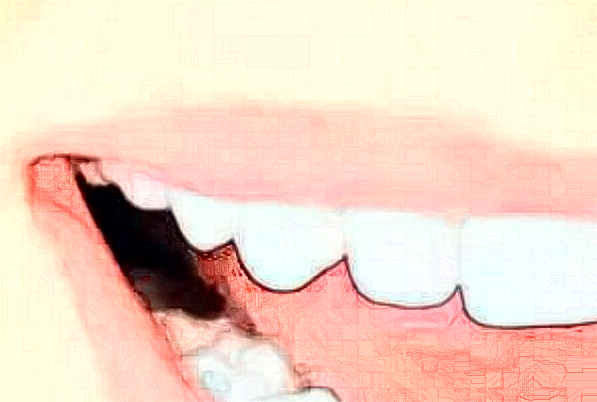 贛州貝殼口腔口腔修復(fù)怎么樣，附醫(yī)生信息一覽~