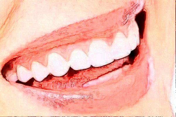 贛州貝殼口腔拔牙怎么樣，附醫(yī)生信息一覽~