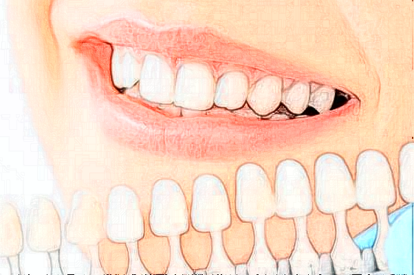 成都茁悅口腔牙體牙髓好嗎_真實案例發(fā)布